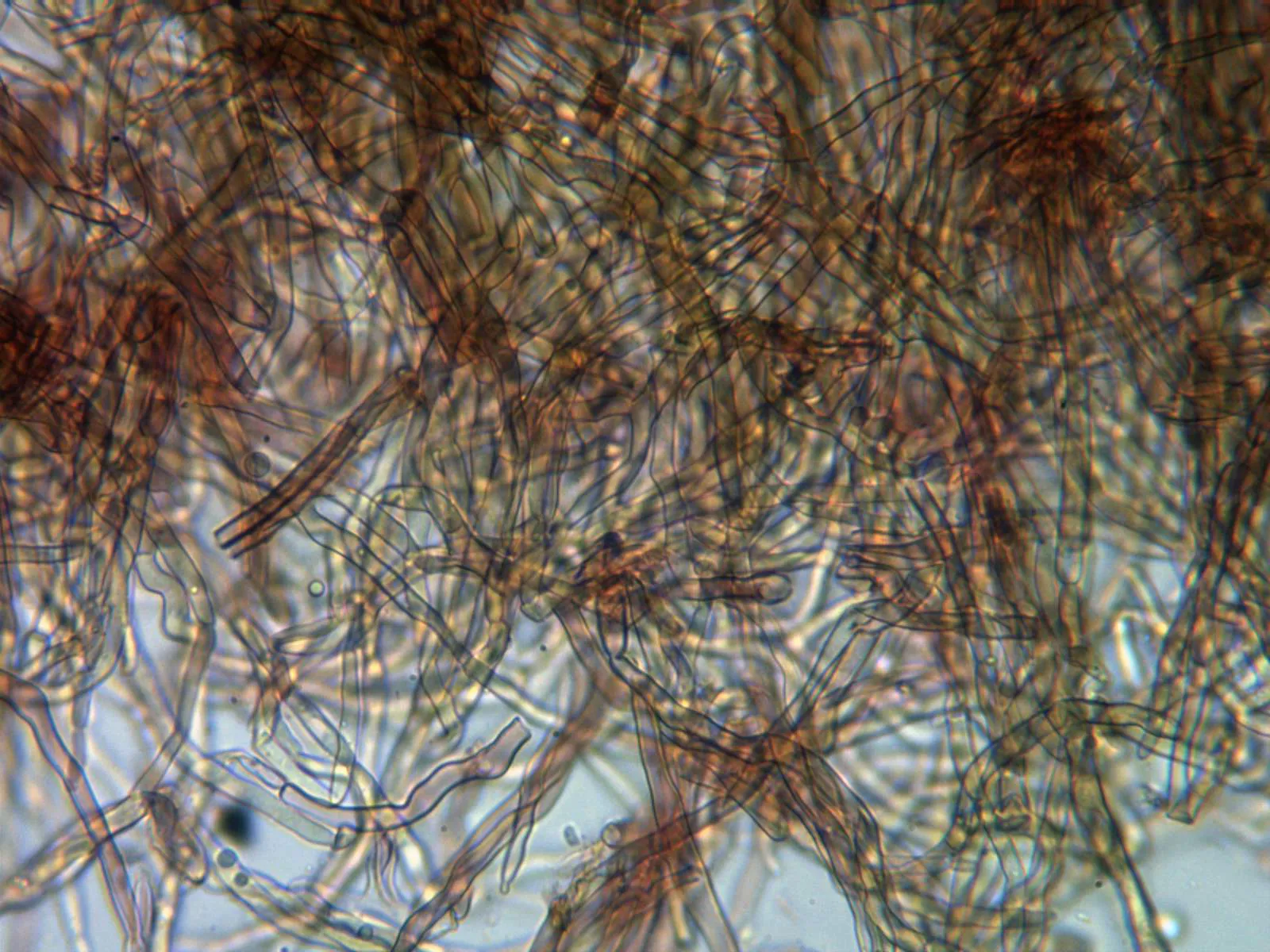 Microscopía de Onnia tomentosa - 15 - Pileipellis x 400 2